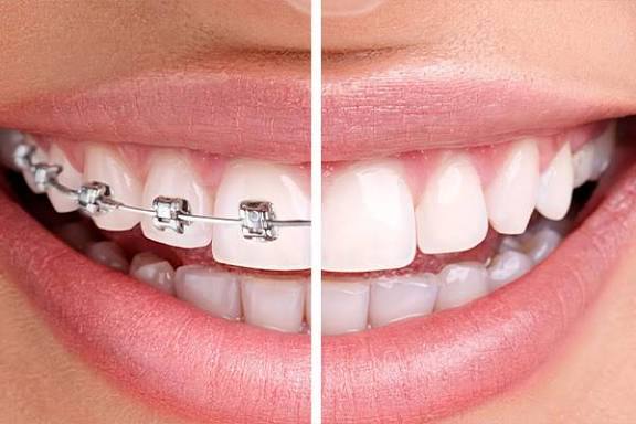 5 Essential Dental Care Tips for a Healthy and Confident Smile